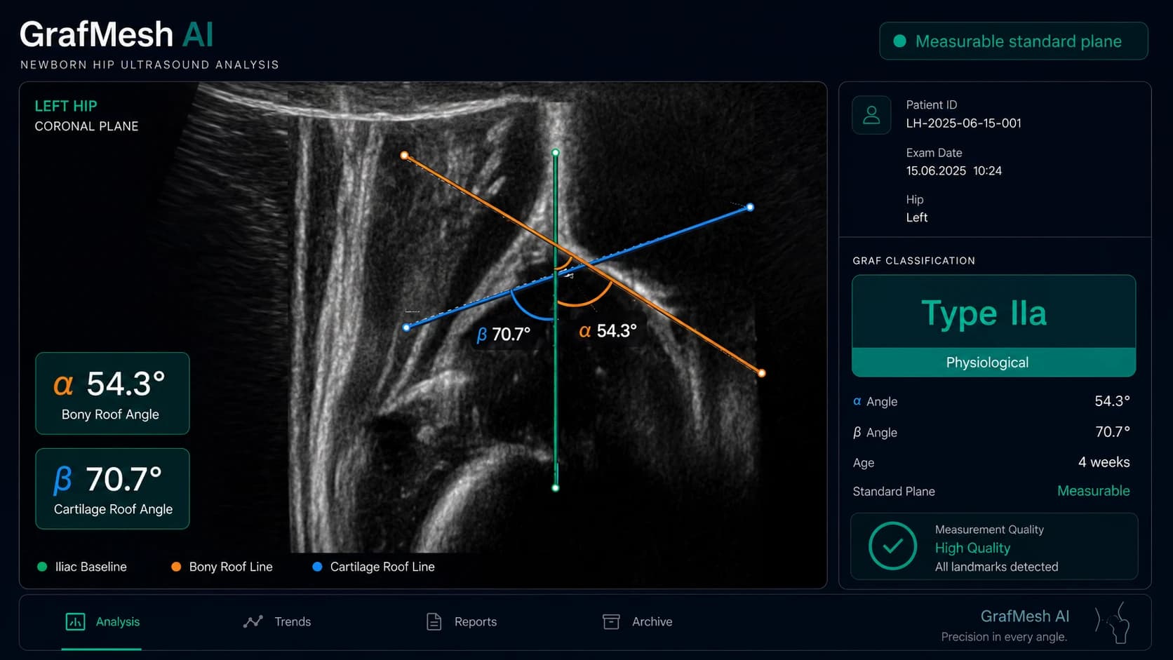 GrafMesh AI: ölçülebilir Graf kesitinde otomatik α/β açı analizi ve Tip IIa sınıflandırması